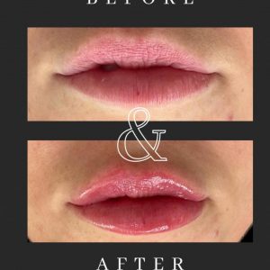 WhatsApp Image 2025-01-11 at 6.13.41 PM